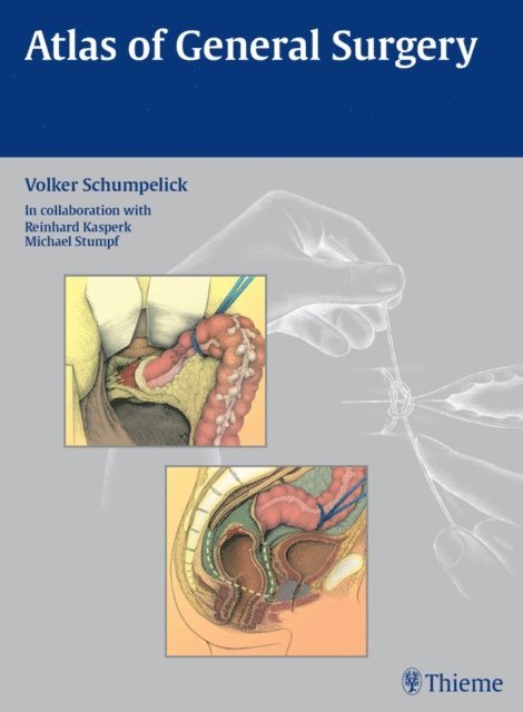 Volker Schumpelick - Atlas of General Surgery, E-bok