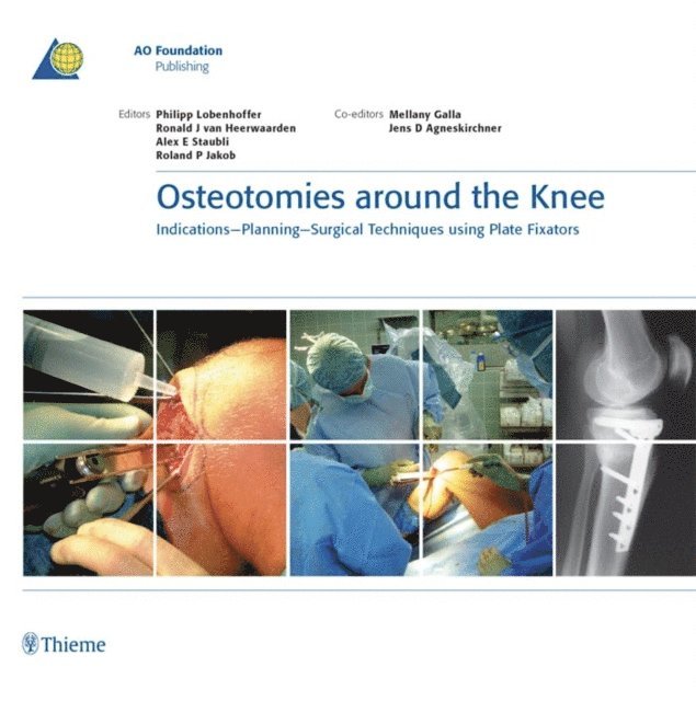 Roland P. Jakob, Alex E. Staubli, Ronald J. van Heerwaarden, Philipp Lobenhoffer - Osteotomies around the Knee, E-bok