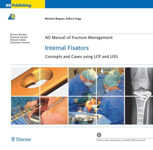 Robert Frigg, Michael Wagner - AO Manual of Fracture Management: Internal Fixators, E-bok