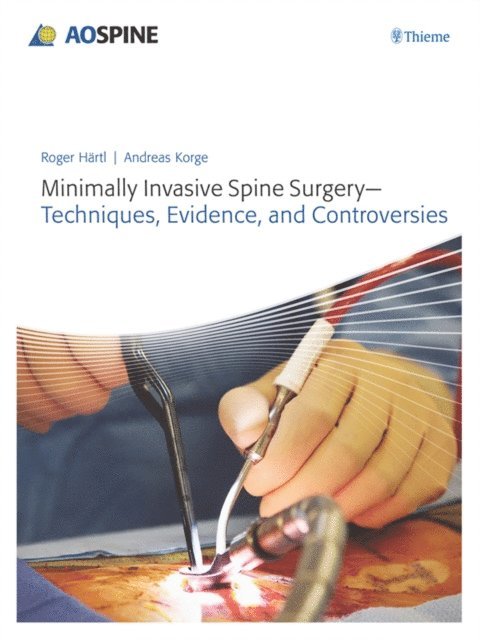 Andreas Korge, Roger Haertl - Minimally Invasive Spine Surgery - Techniques, Evidence, and Controversies, E-bok