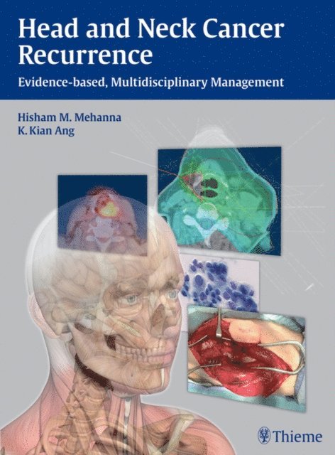K. Kian Ang, Hisham M. Mehanna - Head and Neck Cancer Recurrence, E-bok
