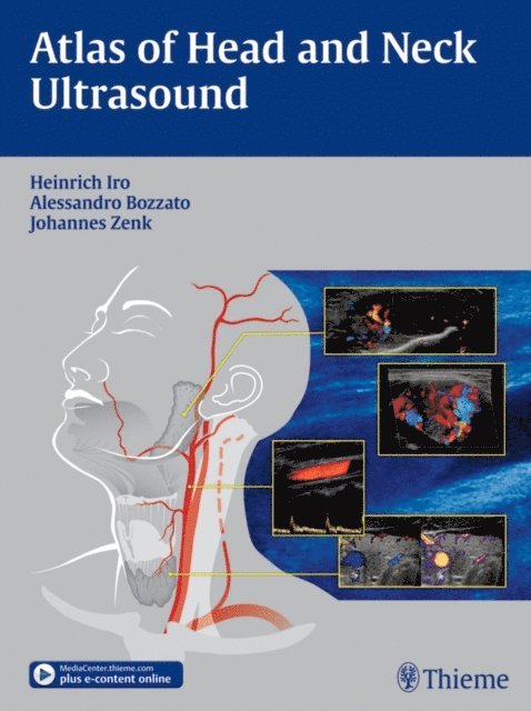 Johannes Zenk, Alessandro Bozzato, Heinrich Iro - Atlas of Head and Neck Ultrasound, E-bok