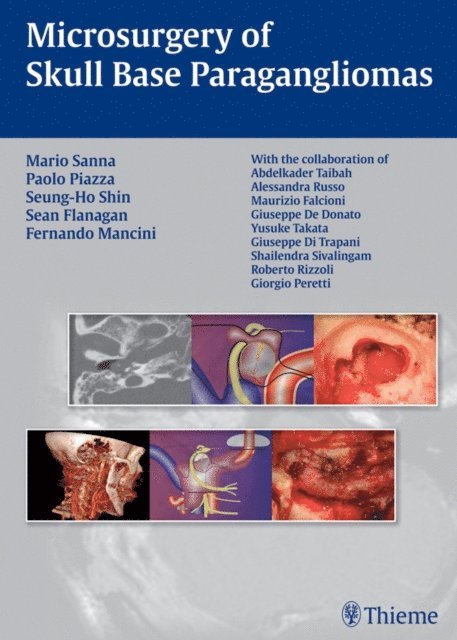 Fernando Mancini, Sean Flanagan, Seung-Ho Shin, Paolo Piazza, Mario Sanna - Microsurgery of Skull Base Paragangliomas, E-bok