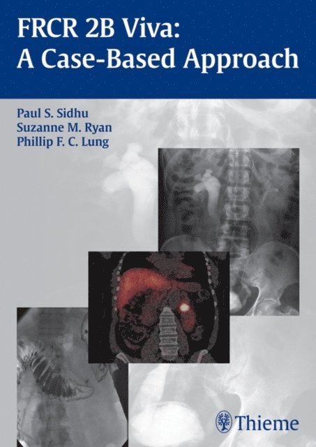 Phillip F.C. Lung, Suzanne Ryan, Paul S. Sidhu - FRCR 2B Viva: A Case-Based Approach, E-bok