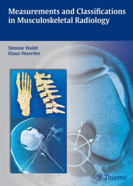 Klaus Wortler, Simone Waldt - Measurements and Classifications in Musculoskeletal Radiology, E-bok
