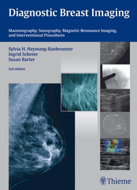 Susan Barter, Ingrid Schreer, Sylvia H. Heywang-Kobrunner - Diagnostic Breast Imaging, E-bok. Tillgänglighet: Lägg i varukorg