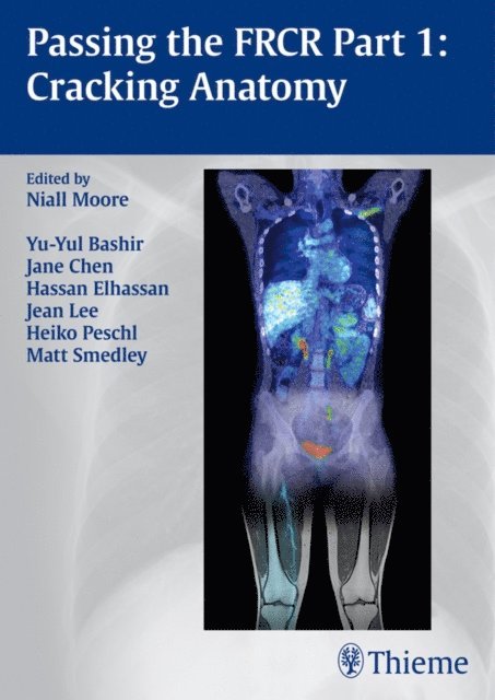 Niall Moore - Passing the FRCR Part 1: Cracking Anatomy, E-bok. Tillgänglighet: Lägg i varukorg