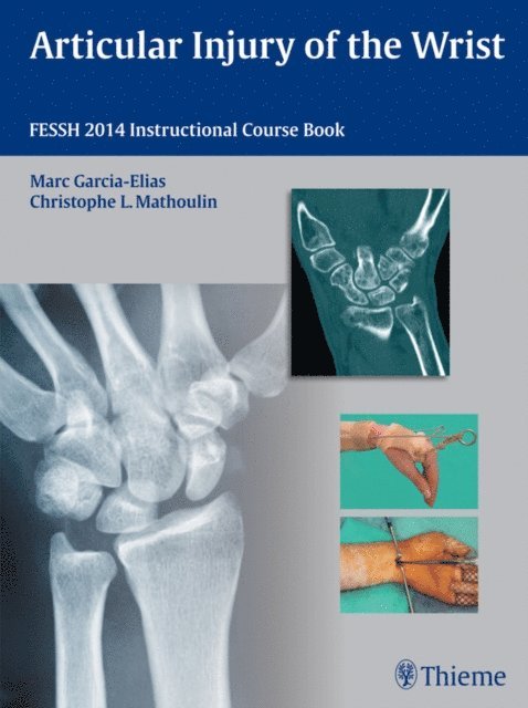 Christophe Mathoulin, Marc Garcia-Elias - Articular Injury of the Wrist, E-bok