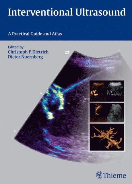 Dieter Nurnberg, Christoph Frank Dietrich - Interventional Ultrasound, E-bok