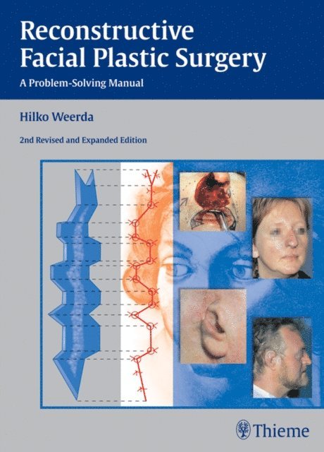 Hilko Weerda - Reconstructive Facial Plastic Surgery, E-bok