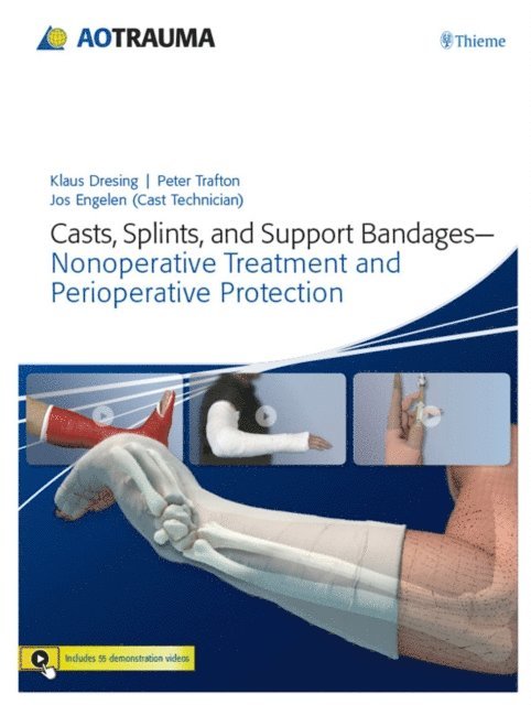 Peter G Trafton, Klaus Dresing - Casts, Splints, and Support Bandages, E-bok