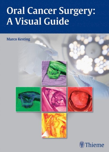 Marco Kesting - Oral Cancer Surgery, E-bok