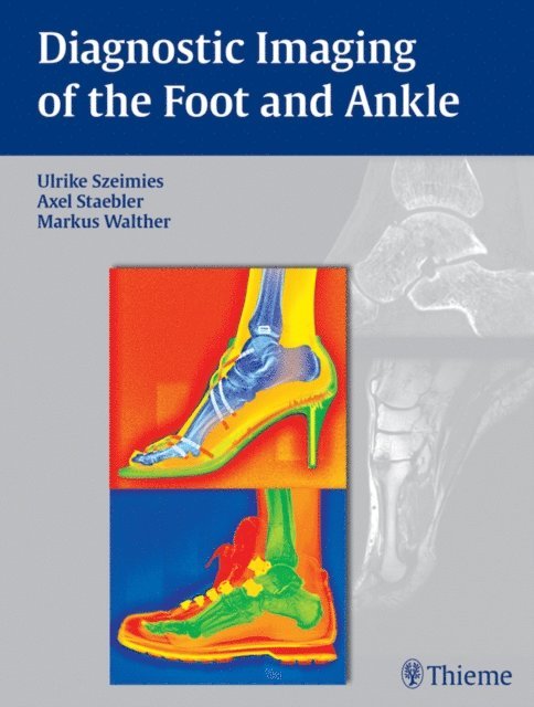 Markus Walther, Axel Stabler, Ulrike Szeimies - Diagnostic Imaging of the Foot and Ankle, E-bok