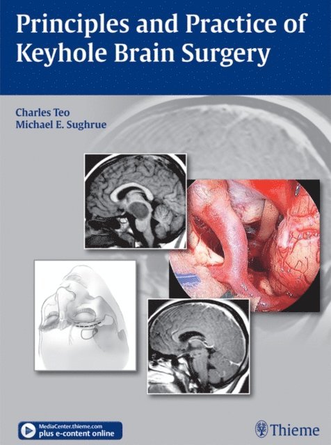 Michael E. Sughrue, Charles Teo - Principles and Practice of Keyhole Brain Surgery, E-bok
