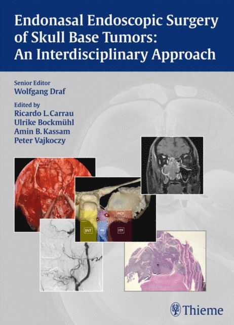 Peter Vajkoczy, Amin B. Kassam, Ulrike Bockmuhl, Ricardo L. Carrau, Wolfgang Draf - Endonasal Endoscopic Surgery of Skull Base Tumors: An Interdisciplinary Approach, E-bok