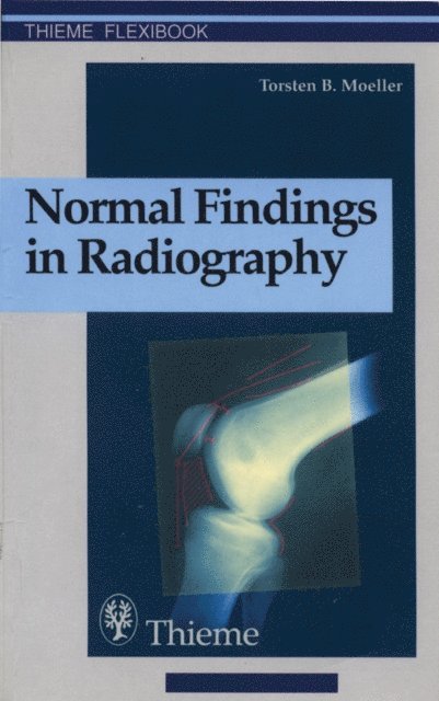 Torsten Bert Moeller - Normal Findings in Radiography, E-bok