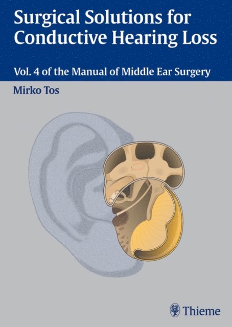 Mirko Tos - Surgical Solutions for Conductive Hearing Loss, E-bok. Tillgänglighet: Lägg i varukorg