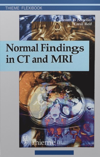 Emil Reif, Torsten Bert Moeller, Torsten Bert Moller - Normal Findings in CT and MRI, E-bok
