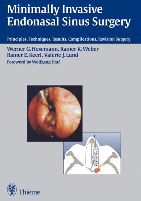 Valerie J. Lund, Rainer Keerl, Rainer K. Weber, Werner G. Hosemann - Minimally Invasive Endonasal Sinus Surgery, E-bok