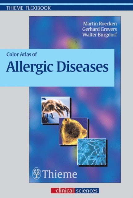 Walter Burgdorf, Gerhard Grevers, Martin Rocken - Color Atlas of Allergic Diseases, E-bok