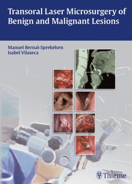 Isabel Vilaseca, Manuel Bernal-Sprekelsen - Transoral Laser Microsurgery of Benign and Malignant Lesions, E-bok