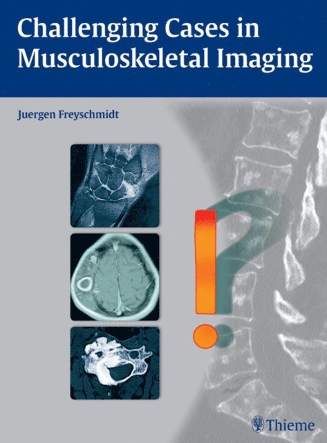 Jurgen Freyschmidt - Challenging Cases in Musculoskeletal Imaging, E-bok
