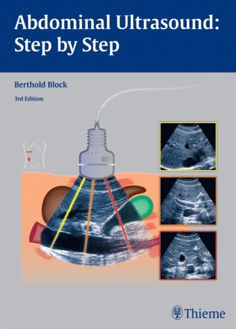 Berthold Block - Abdominal Ultrasound: Step by Step, E-bok. Tillgänglighet: Lägg i varukorg