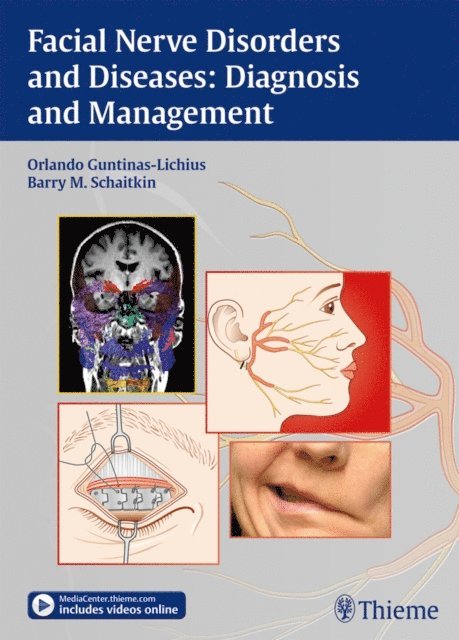 Barry Schaitkin, Orlando Guntinas-Lichius - Facial Nerve Disorders and Diseases: Diagnosis and Management, E-bok