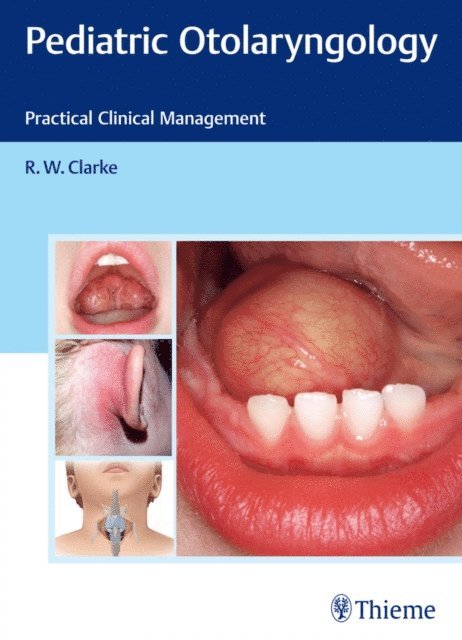 Raymond Clarke - Pediatric Otolaryngology, E-bok