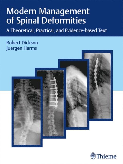 Jurgen Harms, Robert A. Dickson - Modern Management of Spinal Deformities, E-bok