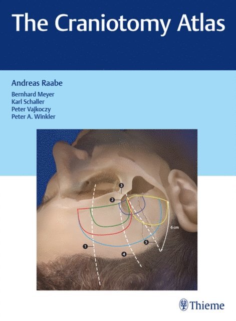 Andreas Raabe - Craniotomy Atlas, E-bok. Tillgänglighet: Lägg i varukorg