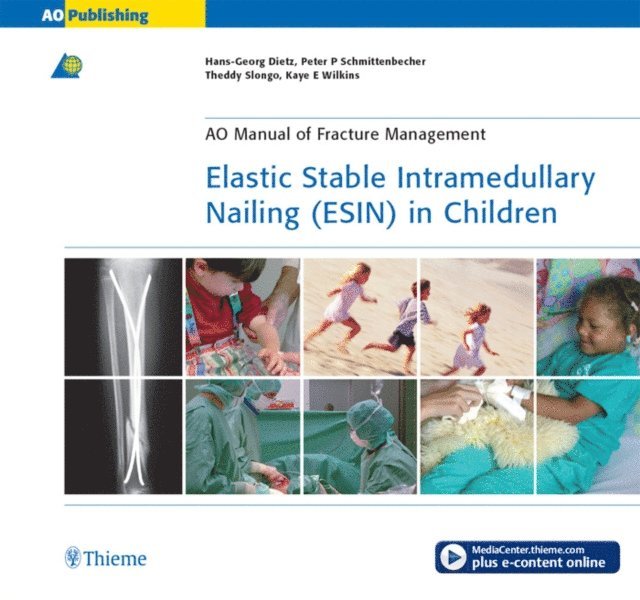 Kaye E. Wilkins, Theddy Slongo, Peter P Schmittenbecher, Hans-Georg Dietz - Elastic Stable Intramedullary Nailing (ESIN) in Children, E-bok
