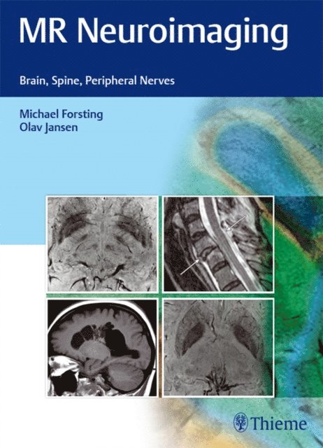 Olav Jansen, Michael Forsting - MR Neuroimaging, E-bok