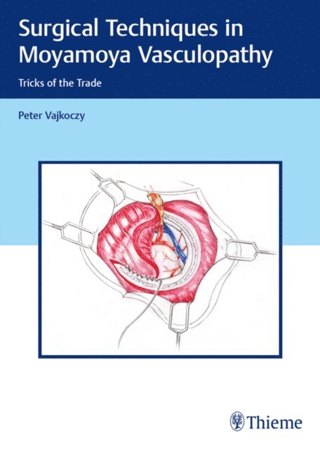 Peter Vajkoczy - Surgical Techniques in Moyamoya Vasculopathy, E-bok