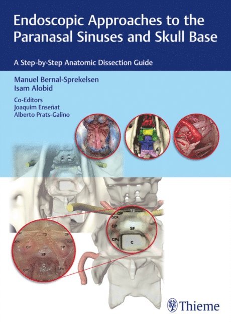 Alberto Prats-Galino, Joaquim Ensenat, Isam Alobid, Manuel Bernal-Sprekelsen - Endoscopic Approaches to the Paranasal Sinuses and Skull Base, E-bok