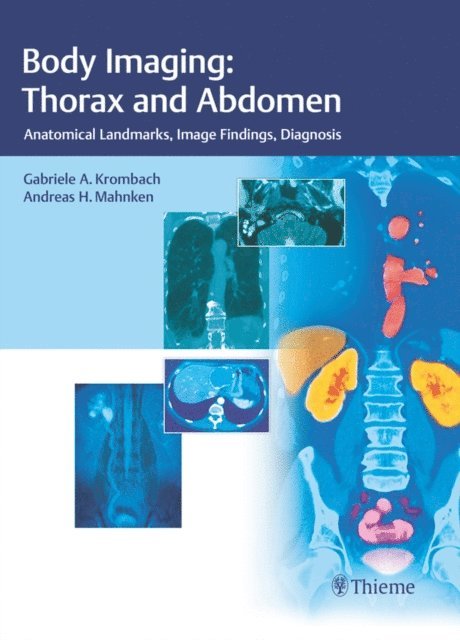 Andreas H. Mahnken, Gabriele A. Krombach - Body Imaging: Thorax and Abdomen, E-bok