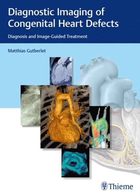 Matthias Gutberlet - Diagnostic Imaging of Congenital Heart Defects, E-bok