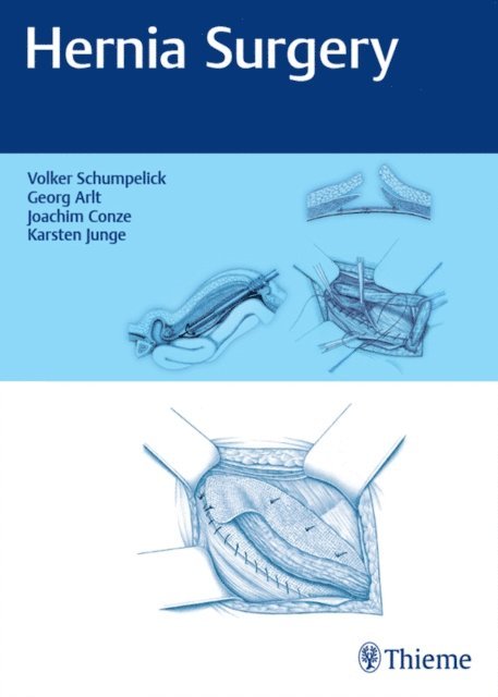 Karsten Junge, Klaus Joachim Conze, Georg Arlt, Volker Schumpelick - Hernia Surgery, E-bok