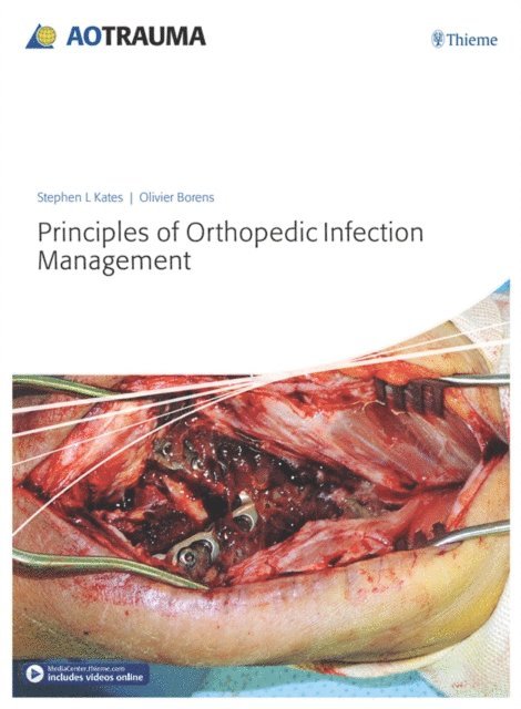 Olivier Borens, Stephen L. Kates - Principles of Orthopedic Infection Management, E-bok