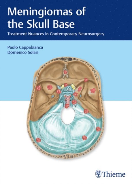 Domenico Solari, Paolo Cappabianca - Meningiomas of the Skull Base, E-bok