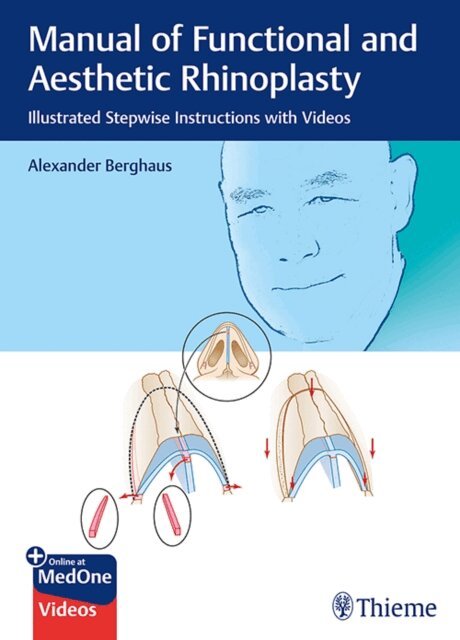 Alexander Berghaus - Manual of Functional and Aesthetic Rhinoplasty, E-bok