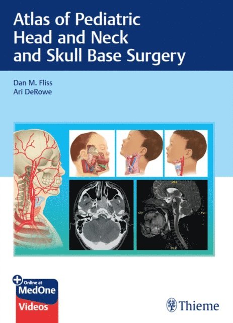 Ari DeRowe, Dan M. Fliss - Atlas of Pediatric Head and Neck and Skull Base Surgery, E-bok