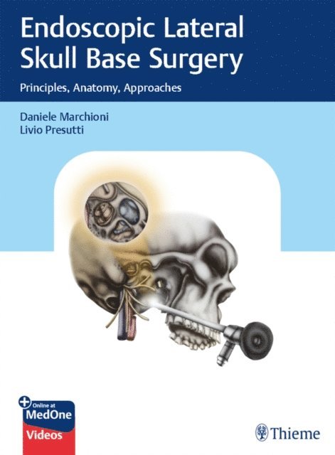 Livio Presutti, Daniele Marchioni - Endoscopic Lateral Skull Base Surgery, E-bok