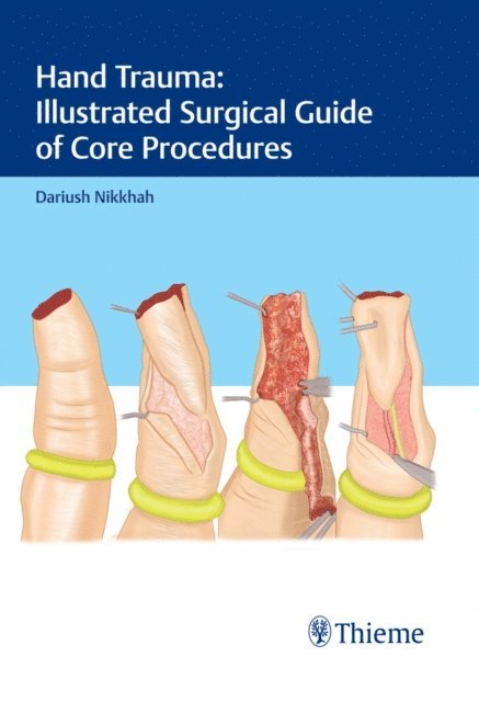 Dariush Nikkhah - Hand Trauma: Illustrated Surgical Guide of Core Procedures, E-bok. Tillgänglighet: Lägg i varukorg