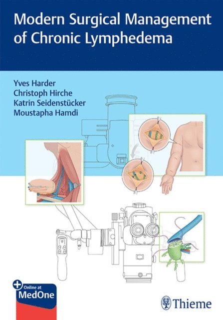 Moustapha Hamdi, Katrin Seidenstucker, Christoph Hirche, Yves Harder - Modern Surgical Management of Chronic Lymphedema, E-bok
