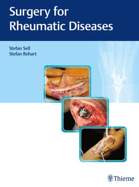 Stefan Rehart, Stefan Sell - Surgery for Rheumatic Diseases, E-bok