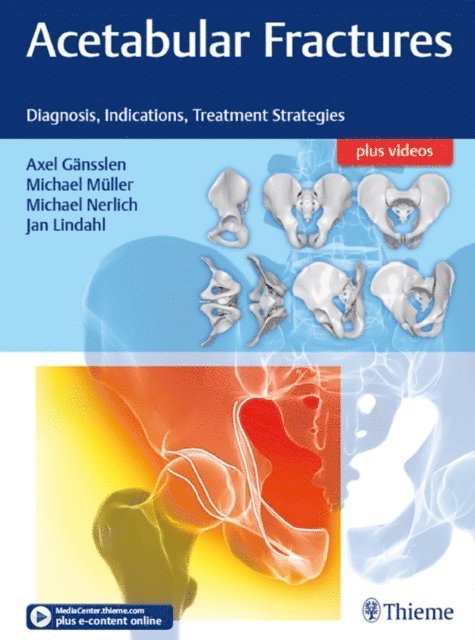 Jan Lindahl, Michael Nerlich, Michael Muller, Axel Gansslen - Acetabular Fractures, E-bok