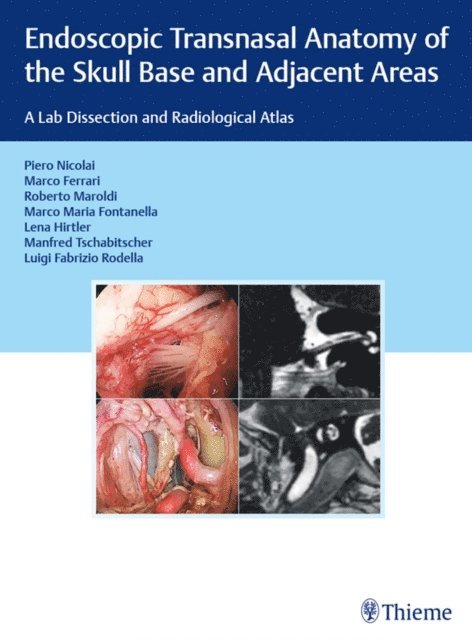 Luigi Fabrizio Rodella, Manfred Tschabitscher, Lena Hirtler, Marco Maria Fontanella, Roberto Maroldi, Marco Ferrari, Piero Nicolai - Endoscopic Transnasal Anatomy of the Skull Base and Adjacent Areas, E-bok