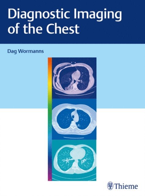 Dag Wormanns - Diagnostic Imaging of the Chest, E-bok