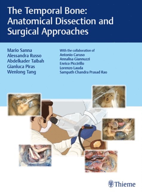 Wenlong Tang, Gianluca Piras, Abdelkader Taibah, Alessandra Russo, Mario Sanna - Temporal Bone, E-bok